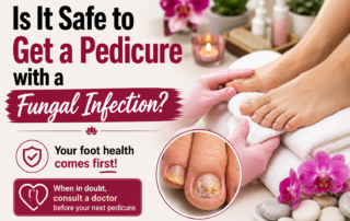 Is It Safe to Get a Pedicure with a Fungal Infection